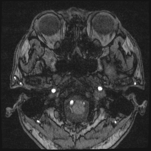 Click on the Serie image to view the images of VILLANUEVA, WILLIAM A.